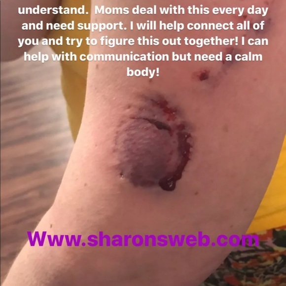 nonspeaking letterboard communication autism spell type dry erase choice - Picture 5 of 16